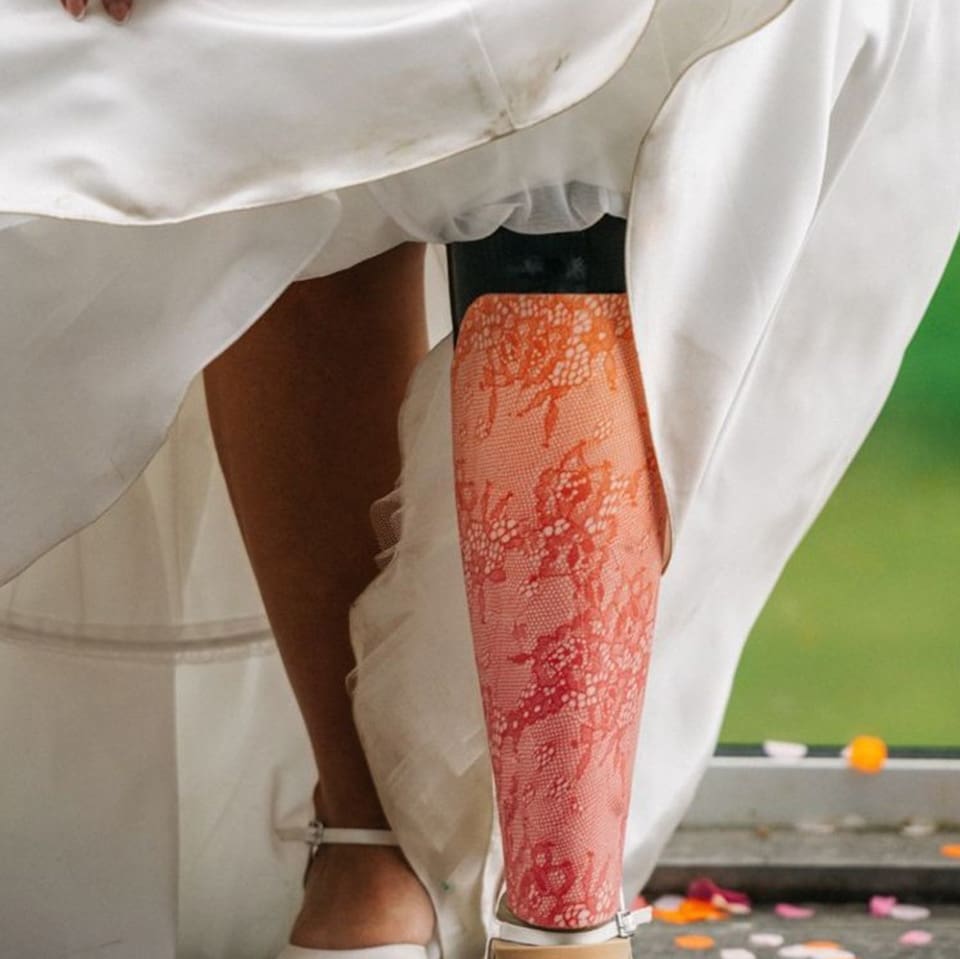 print experts make new prosthetic limb for bride